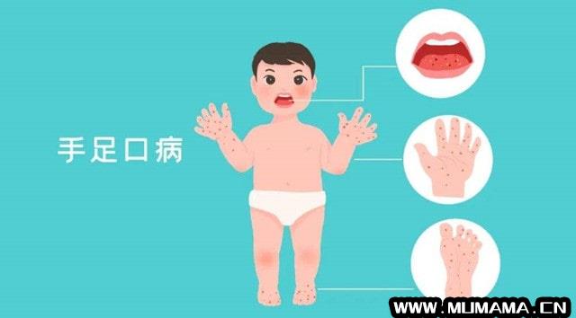 小儿手足口病预防和护理(怎样预防春季传染病)