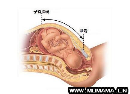 孕妇耻骨位置图 耻骨是哪个部位(真正难熬的耻骨痛)