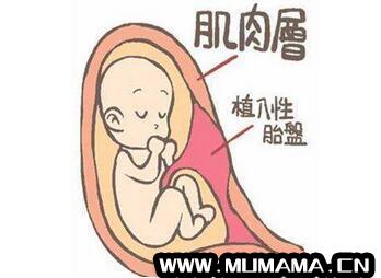 胎盘植入怎么检查出来