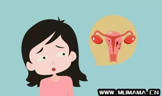 子宫腺肌症能怀孕吗
