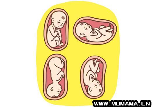 孕晚期胎位不正，还能顺产吗？怎么纠正？