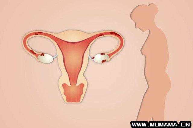 子宫保养要避免10个伤子宫的行为(需避免伤害子宫的7大行为)