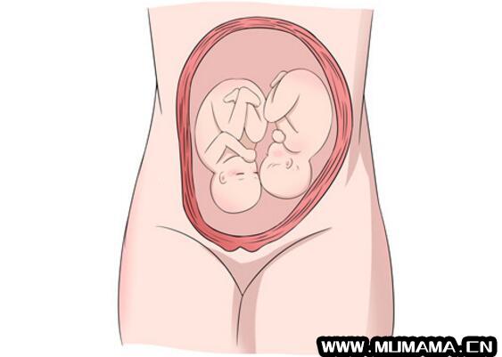 怀了双胞胎，准妈妈只能做剖宫产吗？(孕妇怀了双胞胎)