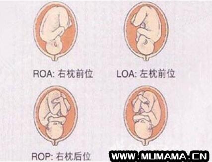 胎位roa和loa各是什么意思(孕28周后会有22种胎位)