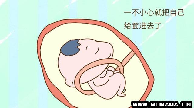 脐带绕颈一般会发生在胎儿发育的第几个月？