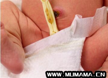 新生儿肚脐发炎症状有哪些？新生儿脐炎怎么办？