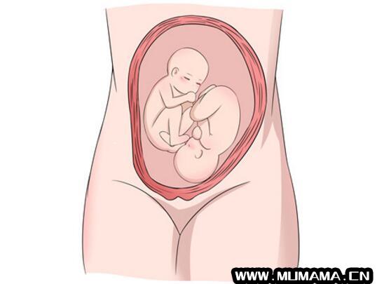 怀了双胞胎，准妈妈只能做剖宫产吗？
