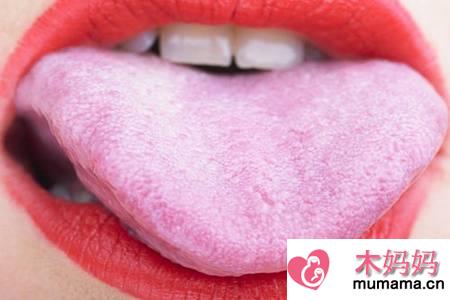 舌头发白什么原因,女性舌苔后白小心肠胃疾病