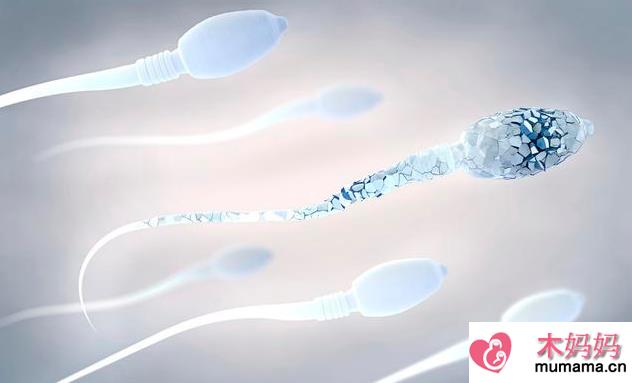 精子精子是什么原因 精子畸形率高怎么办