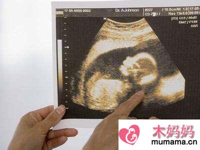 新一代香港验血技术可提前7天便知胎儿性别