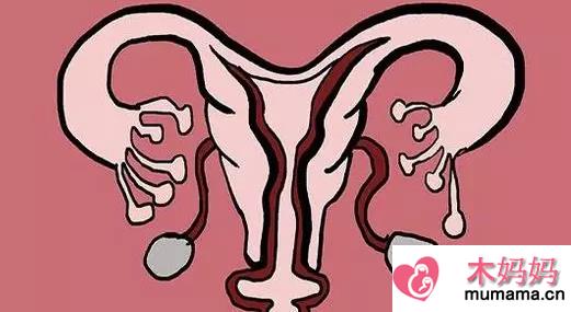 子宫内膜太厚是什么原因 子宫内膜太厚怎么办