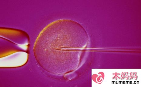 人工授精的促排卵和试管婴儿一样吗 人工授精的促排卵和试管婴儿区别