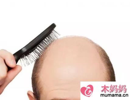 男性中年秃顶是怎么回事 中年男性容易秃顶吗