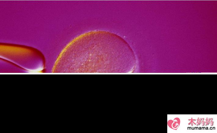 人工受孕怎么取出精子的 人工受孕成功率高吗