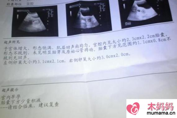 胎停育后成功怀孕经验 胎停一个月后立刻怀孕宝宝健康出生