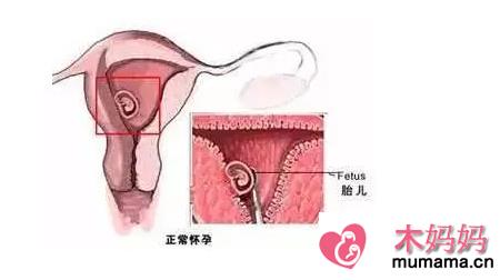 输卵管通而不畅是什么意思 输卵管通而不畅的原因有哪些