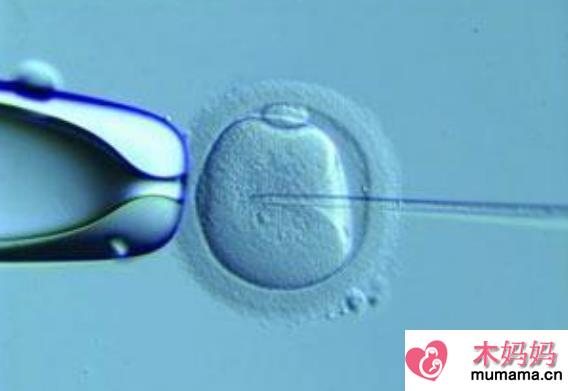 试管婴儿鲜胚和冻胚哪个好 试管婴儿胚胎移植方式怎么选2018
