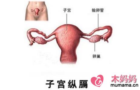 得了纵膈子宫能怀孕吗 子宫纵隔的症状有哪些