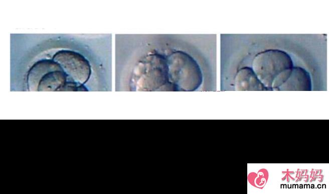 冻胚培养囊胚什么时候做 怎么知道是否成功培养成囊胚