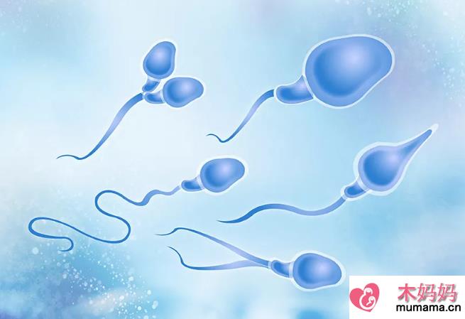 精液常规检查主要有哪些项目 怎么知道精子是否健康