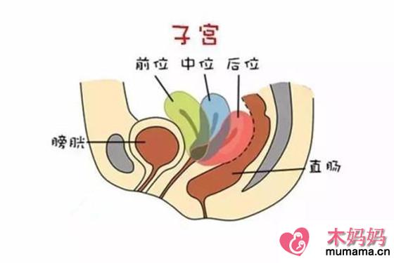 了解子宫前位和后位的区别 为快速受孕作准备