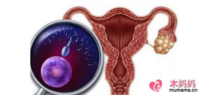 多囊卵巢可以自然怀孕吗 多囊卵巢女性怎么备孕