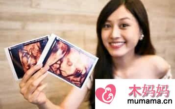 美女主播郭惠妮生双胞胎女儿,怀双胞胎孕妈必知的注意事项