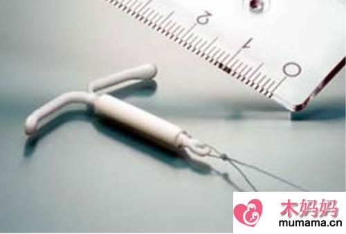 曼月乐环可以治疗子宫腺肌症吗 曼月乐环有什么副作用