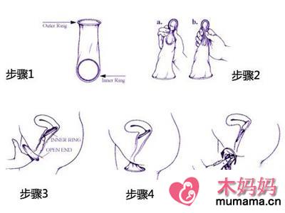 女用避孕套使用方法图解 女用避孕套哪个牌子好用