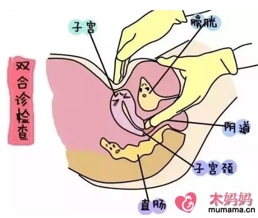 子宫后位迅速怀孕的技巧 哪些疾病会造成子宫后位