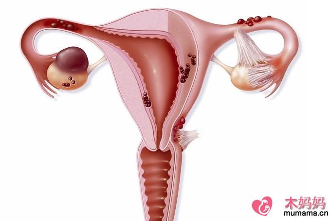 备孕检查做输卵管造影疼吗 影响输卵管造影疼痛的因素