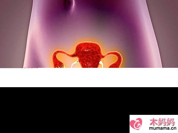 输卵管积液做腹腔镜了怀孕率还是低吗 输卵管积液处理方法