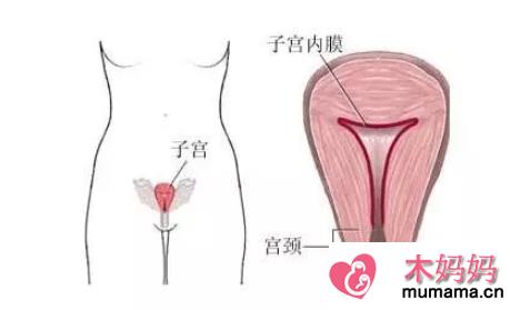 子宫内膜太薄会不孕吗 子宫内膜薄有哪些症状