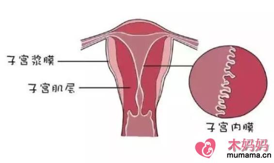 子宫内膜太薄会不孕吗 子宫内膜薄有哪些症状