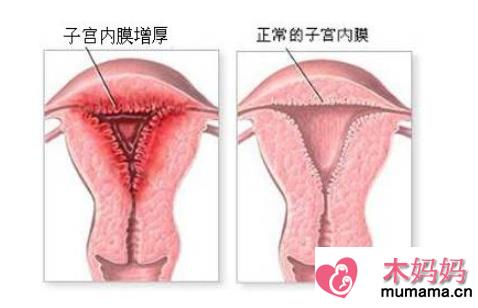 子宫内膜太薄不来月经怎么办 子宫内膜太薄和不来月经有关吗