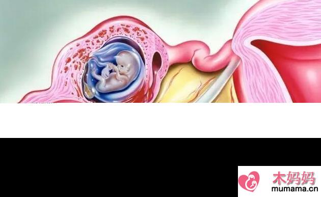 慢性输卵管炎会影响怀孕吗 慢性输卵管炎治疗方法