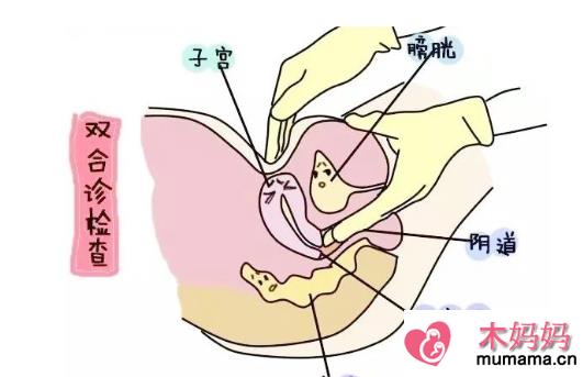 子宫前置怎么容易怀孕 备孕子宫前置好不好